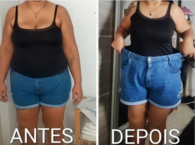 Antes e depois de cliente do Projeto Corpo dos Sonhos