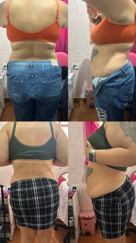 Antes (topo) e depois (embaixo) de cliente do Projeto Corpo dos Sonhos