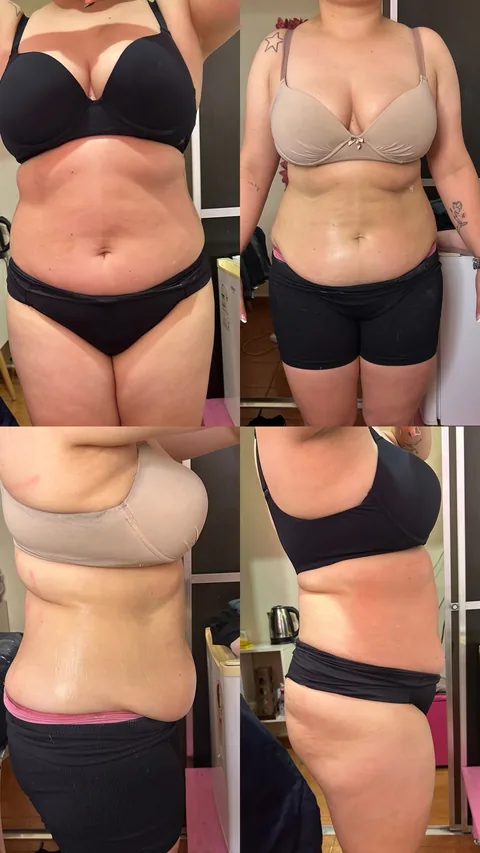 Antes (topo) e depois (embaixo) de cliente do Projeto Corpo dos Sonhos