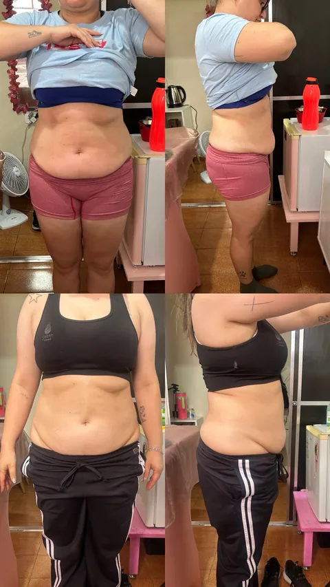 Antes (topo) e depois (embaixo) de cliente do Projeto Corpo dos Sonhos