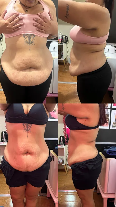 Antes (topo) e depois (embaixo) de cliente do Projeto Corpo dos Sonhos