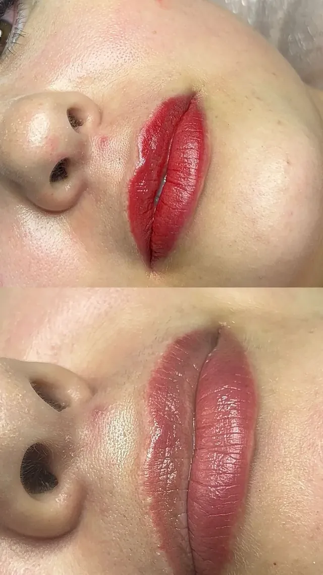 Antes e depois de micropigmentação labial