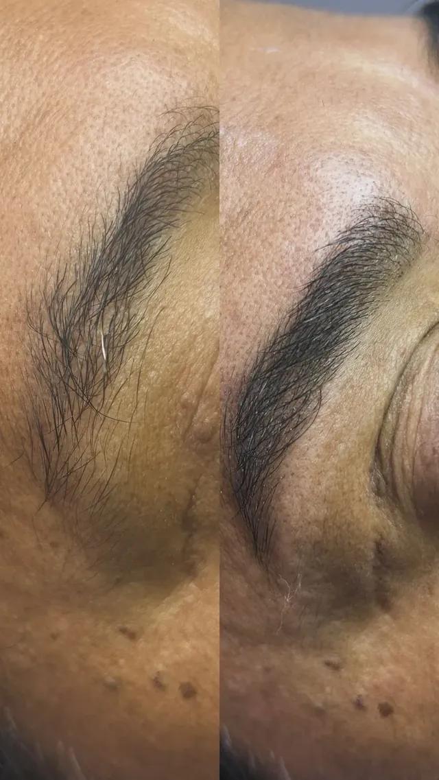 Antes e depois de design de sobrancelha
